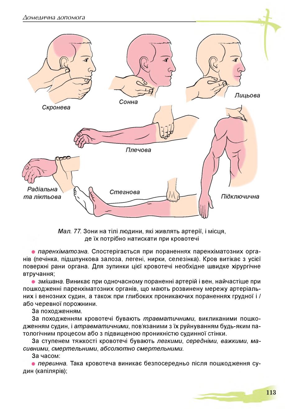 Мініатюра 113