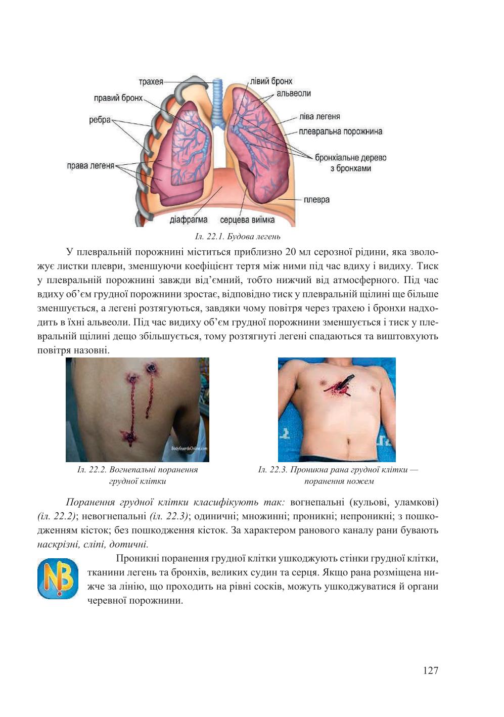 Мініатюра 127