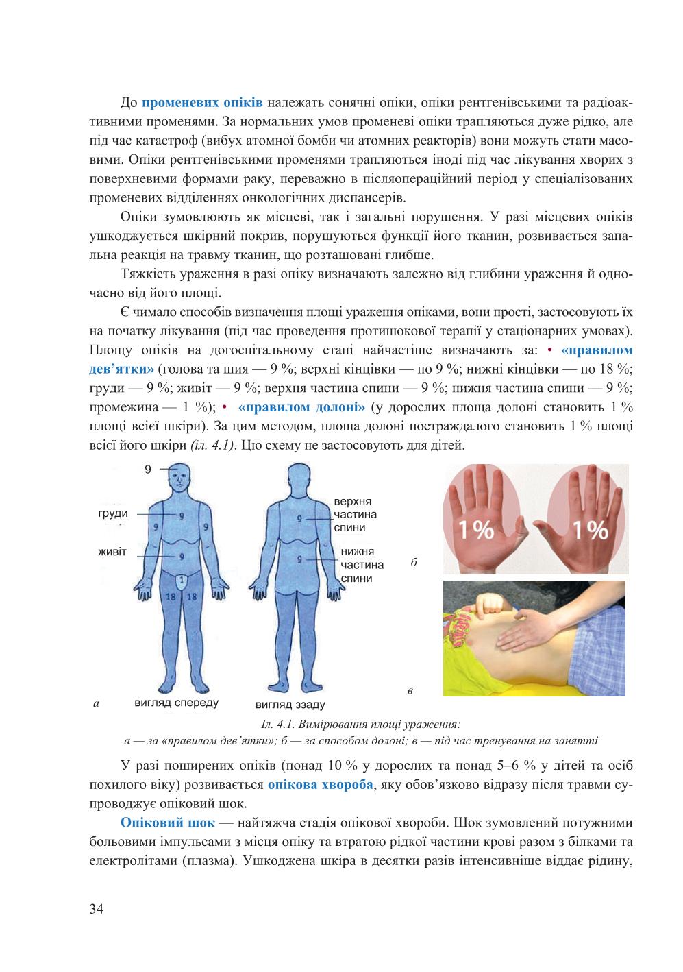 Мініатюра 34