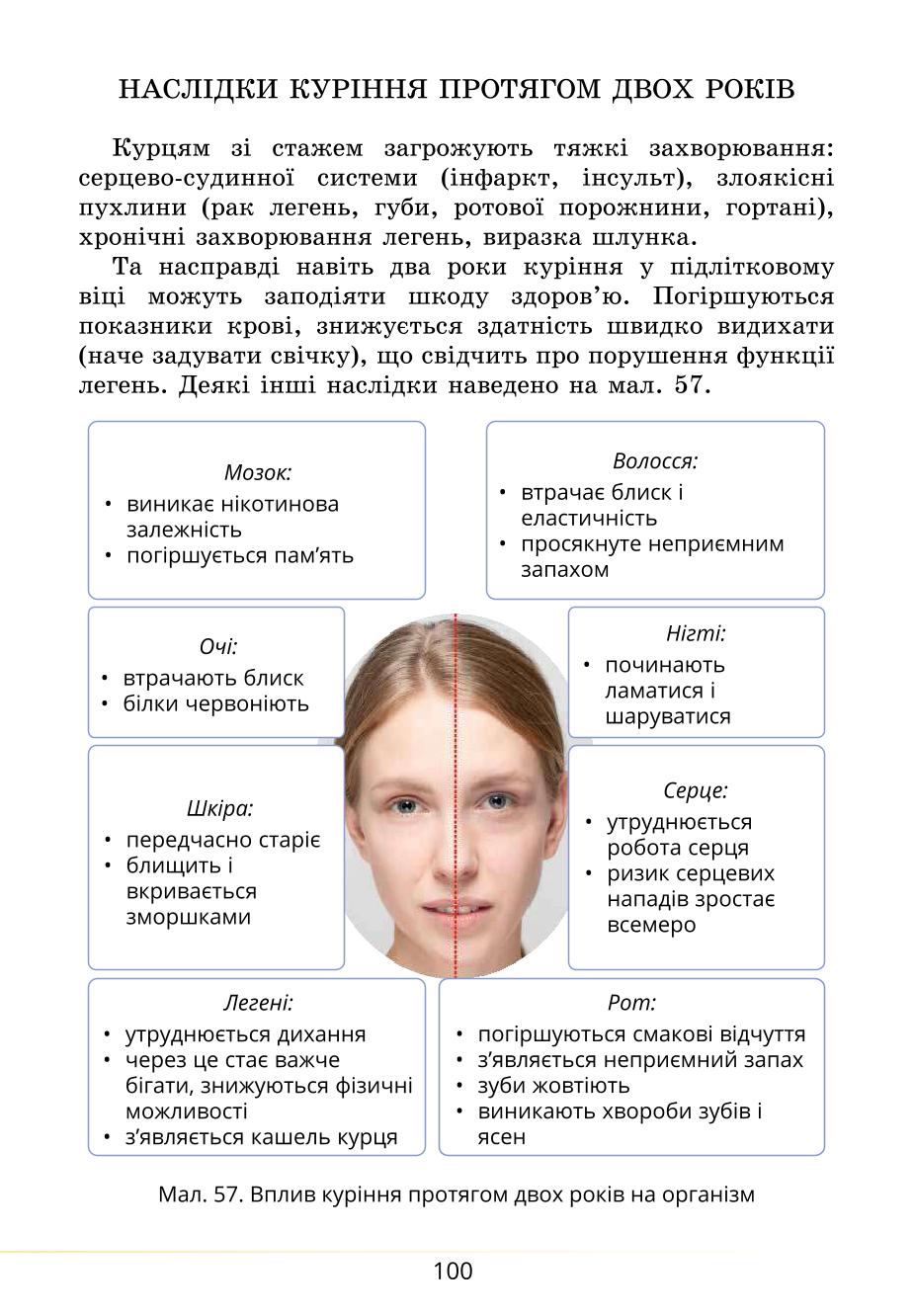 Мініатюра 100