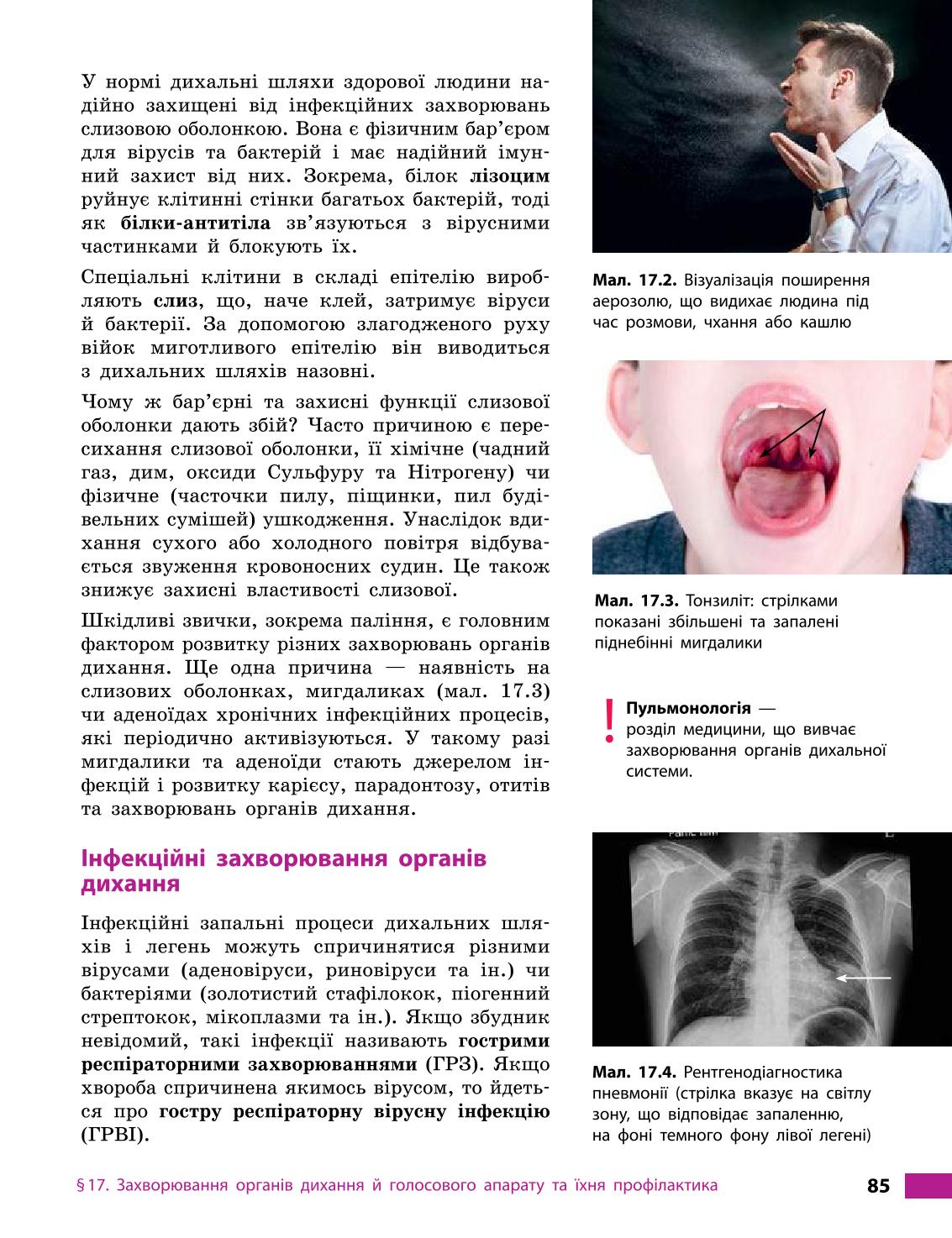 Мініатюра 85