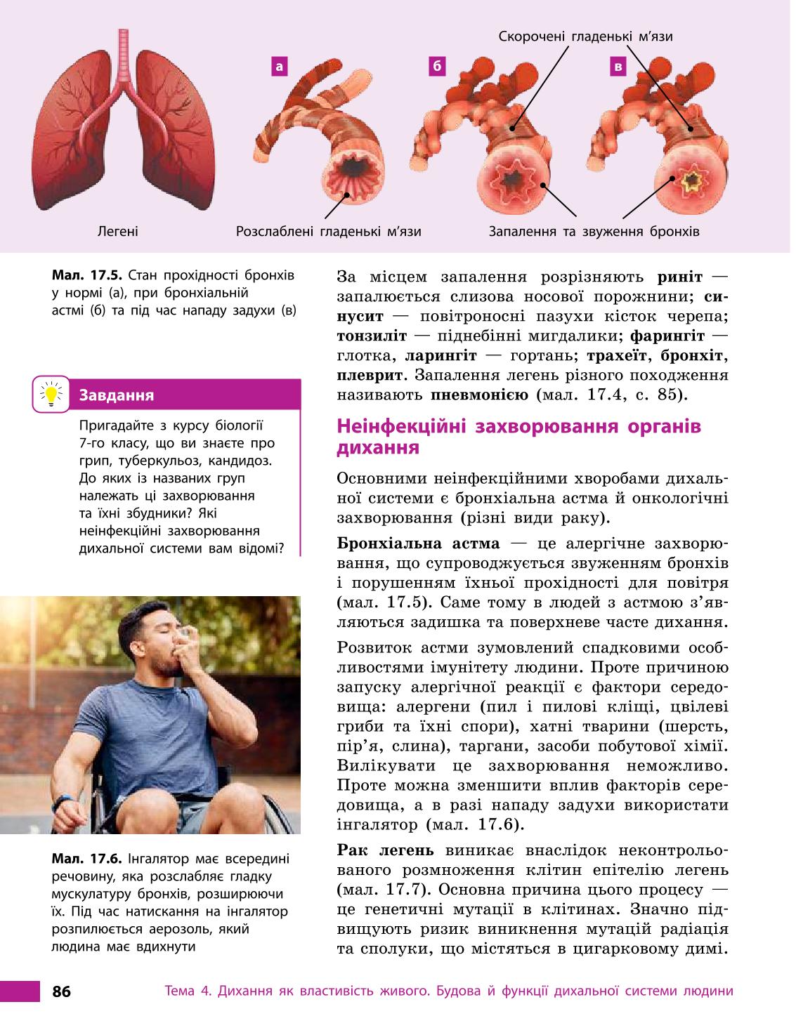 Мініатюра 86