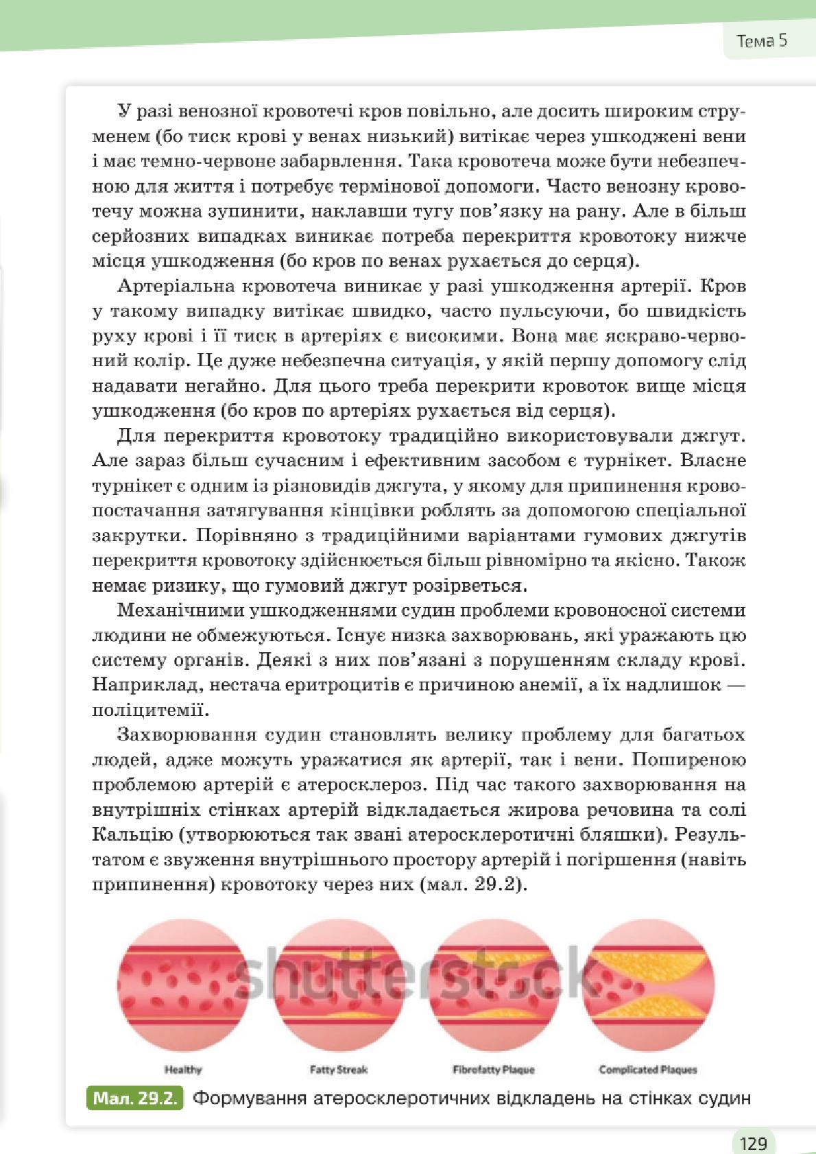 Мініатюра 129
